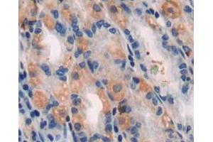 Used in DAB staining on fromalin fixed paraffin-embedded stomach tissue (TUBB1 antibody  (AA 166-451))