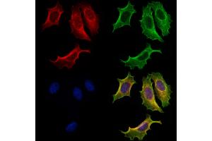 ABIN7094811 and ABIN7098862 staining Hela cells by IF/ICC.