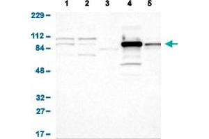 Western Blot analysis of (1) human cell line RT-4 (2) human cell line U-251MG sp (3) human plasma (IgG/HSA depleted) (4) human liver tissue, and (5) human tonsil tissue. (Glucose-6-Phosphate Dehydrogenase antibody  (AA 43-154))