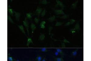 Immunofluorescence analysis of C6 cells using ZWINT Polyclonal Antibody at dilution of 1:100 (40x lens). (ZWINT antibody)