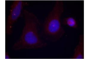 Image no. 3 for anti-PTK2B Protein tyrosine Kinase 2 beta (PTK2B) (pTyr402) antibody (ABIN196952) (PTK2B antibody  (pTyr402))