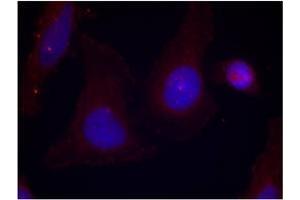 Image no. 3 for anti-PTK2B Protein tyrosine Kinase 2 beta (PTK2B) (pTyr402) antibody (ABIN196953) (PTK2B antibody  (pTyr402))