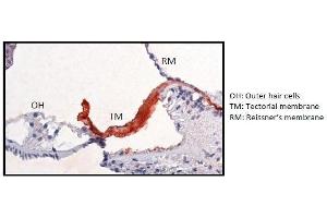 Immunohistological staining using SU-9D5 on paraffin sections of cochlea tissue of an adult transgenic mouse with a human CEACAM16 gene (Ceacam16+/+ mouse cochlea). (CEACAM16 antibody)