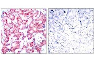 Image no. 1 for anti-GATA Binding Protein 1 (Globin Transcription Factor 1) (GATA1) (pSer142) antibody (ABIN196684) (GATA1 antibody  (pSer142))