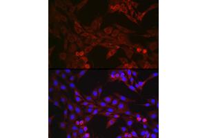 Immunofluorescence analysis of NIH/3T3 cells using GSDMD (Full Length+C terminal) Rabbit pAb (ABIN7267350) at dilution of 1:250 (40x lens). (GSDMD antibody  (AA 276-484))