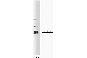 Western blot analysis of Caveolin 1 on a human endothelial lysate. (Caveolin-1 antibody  (AA 1-97))