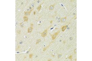 Immunohistochemistry of paraffin-embedded rat brain using SLC25A1 antibody (ABIN5998842) at dilution of 1/100 (40x lens).