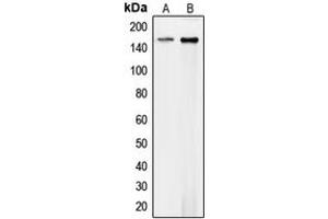 Western blot analysis of Collagen 4 alpha 1 expression in HEK293T (A), mouse endothelial (B) whole cell lysates. (COL4A1 antibody  (N-Term))
