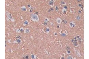 DAB staining on IHC-P; Samples: Human Brain Tissue (KIF5A antibody  (AA 473-605))