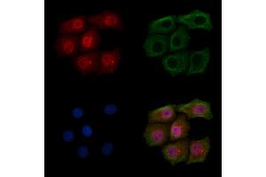 ABIN6254999 and ABIN6267500 staining HepG2 cells(4h of LPS treatment) by IF/ICC.
