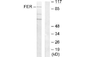 Western blot analysis of extracts from HeLa cells, using FER antibody. (FER antibody)