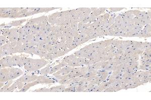 Detection of MYOC in Human Cardiac Muscle Tissue using Polyclonal Antibody to Myocilin (MYOC) (MYOC antibody  (AA 224-471))