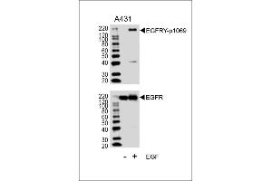 Western blot analysis of lysates from A431 cell line, untreated or treated with EGF, 100 ng/mL, using EGFRY Antibody (p1069) (ABIN1881283 and ABIN2839662) (upper) or EGFR (lower). (EGFR antibody  (pTyr1069))