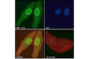 ABIN570707 Immunofluorescence analysis of paraformaldehyde fixed U2OS cells, permeabilized with 0. (E2F8 antibody  (Internal Region))
