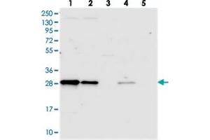 Western blot analysis of Lane 1: RT-4, Lane 2: U-251 MG, Lane 3: Human Plasma, Lane 4: Liver, Lane 5: Tonsil with TRPT1 polyclonal antibody .
