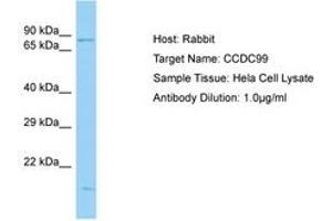 Image no. 1 for anti-Protein Spindly (SPDL1) (C-Term) antibody (ABIN6750167) (Spindly antibody  (C-Term))