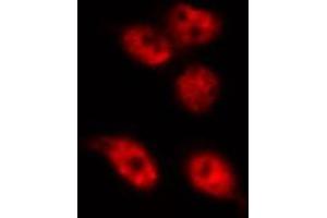 ABIN6268811 staining HeLa by IF/ICC. (RBMX antibody  (N-Term))