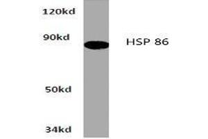 Image no. 1 for anti-Heat Shock Protein 90kDa alpha (Cytosolic), Class A Member 1 (HSP90AA1) antibody (ABIN265473) (HSP90AA1 antibody)