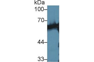 Western Blot; Sample: Mouse Skeletal muscle lysate; Primary Ab: 1µg/ml Rabbit Anti-Human CaN Antibody Second Ab: 0. (CAN antibody  (AA 7-301))