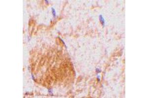 Immunohistochemistry of Il31 in rat skeletal muscle tissue with Il31 polyclonal antibody  at 10 ug/mL . (IL-31 antibody  (N-Term))