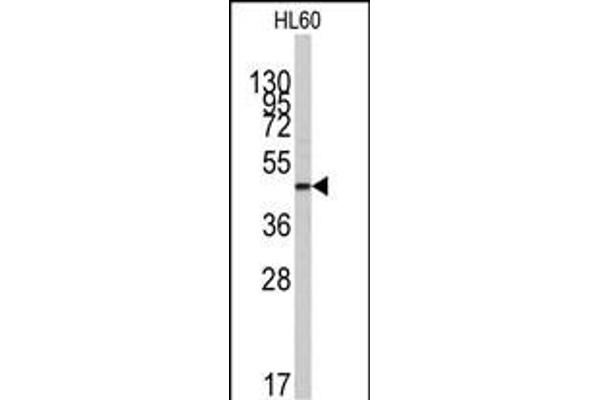 ZIC3 antibody  (N-Term)