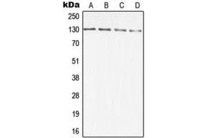 Western blot analysis of DIAPH2 expression in A431 (A), HCT116 (B), SP2/0 (C), PC12 (D) whole cell lysates. (DIAPH2 antibody  (Center))