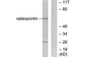 Western blot analysis of extracts from LOVO cells, using Osteopontin Antibody. (Osteopontin antibody  (AA 261-310))
