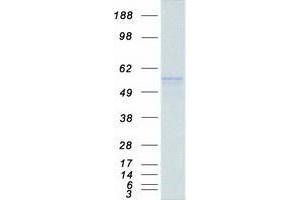 Validation with Western Blot (Peripherin Protein (PRPH) (Myc-DYKDDDDK Tag))