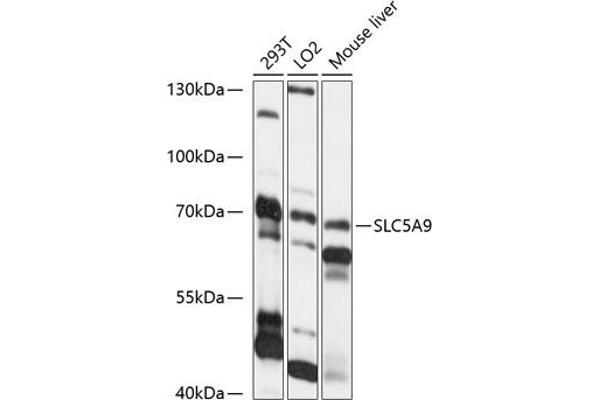 SLC5A9 antibody  (AA 230-320)