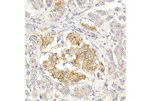 Immunohistochemistry of paraffin-embedded Human islet using CD99 Rabbit pAb (ABIN3022730, ABIN3022731, ABIN3022732, ABIN1512728 and ABIN6219199) at dilution of 1:50 (40x lens). (CD99 antibody  (AA 23-185))