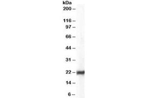 Western blot testing of HeLa lysate with HP1 antibody at 0. (CBX5 antibody)