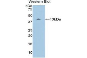 Western Blotting (WB) image for anti-Complement Component 8, beta Polypeptide (C8B) (AA 161-503) antibody (ABIN3206898) (C8B antibody  (AA 161-503))