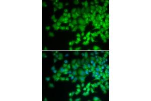 Immunofluorescence analysis of U2OS cells using NCF4 antibody (ABIN5971122). (NCF4 antibody)