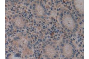 DAB staining on IHC-P; Samples: Human Stomach Tissue (VPREB1 antibody  (AA 33-135))