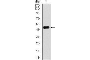 Western blot analysis using ACLY mAb against human ACLY recombinant protein. (ACLY antibody  (AA 306-502))