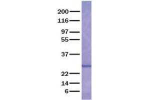 Validation with Western Blot (ARTN Protein (Transcript Variant 4))