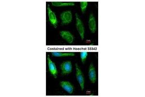 ICC/IF Image Immunofluorescence analysis of methanol-fixed HeLa, using ALDH1A1, antibody at 1:200 dilution. (ALDH1A1 antibody  (C-Term))