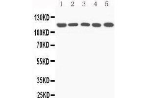 Western Blotting (WB) image for anti-Complement Component 5 (C5) (AA 1-18), (N-Term) antibody (ABIN3044294) (C5 antibody  (N-Term))