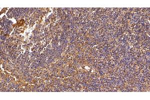 Detection of IL8 in Porcine Lymph node Tissue using Polyclonal Antibody to Interleukin 8 (IL8) (IL-8 antibody  (AA 23-101))