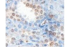 Immunohistochemical analysis of paraffin-embedded human fetal kidney showing cytoplasmic staining with ABHD12B polyclonal antibody  at a 1 : 100 dilution. (ABHD12B antibody  (AA 78-284))