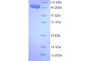 SDS-PAGE (SDS) image for Interleukin 12 Receptor, beta 2 (IL12RB2) (AA 24-622), (Extracellular) protein (His tag) (ABIN5714452)