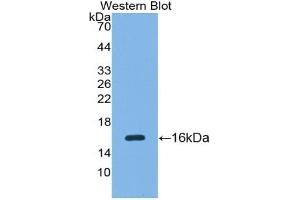 Western blot analysis of the recombinant protein. (SFRP5 antibody  (AA 48-165))