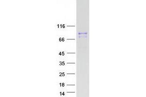 Validation with Western Blot