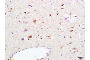 Formalin-fixed and paraffin embedded rat brain tissue labeled Anti-NCAM1 Polyclonal Antibody, Unconjugated  at 1:200, followed by conjugation to the secondary antibody and DAB staining