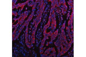 IF analysis of TOMM20 using anti-TOMM20 antibody (ABIN7600883).