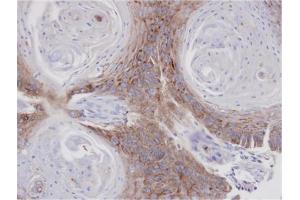 AP31121PU-N ANXA7 antibody staining of paraffin-embedded Cal27 xenograft at 1/1000 dilution. (Annexin VII antibody  (AA 122-419))