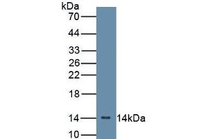 Western blot analysis of recombinant Mouse CFB. (Complement Factor B antibody  (AA 32-157))