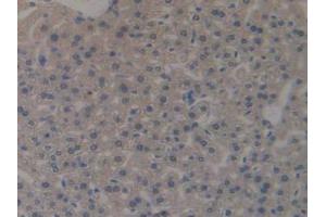 IHC-P analysis of Mouse Liver Tissue, with DAB staining. (MUC1 antibody  (AA 474-630))