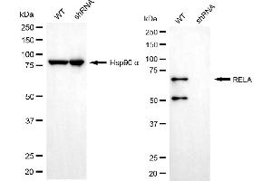 Western blotting analysis using RELA antibody (ABIN7799646). (NF-kB p65 antibody)