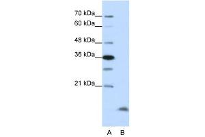 Western Blot showing CCNB3 antibody used at a concentration of 1-2 ug/ml to detect its target protein.